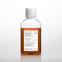 Donor Horse Serum